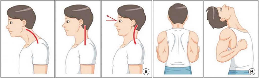 neck-exercise-dr-takacs-chiropractor-nj